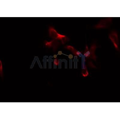 Western blot analysis of extracts from rat brain, using ABCB10 Antibody. Lane 1 was treated with the blocking peptide.