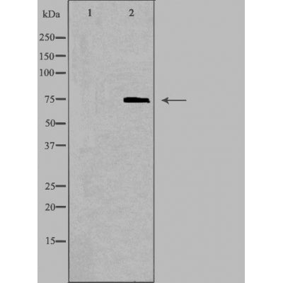 DF3813 staining Hela by IF/ICC. The sample were fixed with PFA and permeabilized in 0.1% Triton X-100,then blocked in 10% serum for 45 minutes at 25¡ãC. The primary antibody was diluted at 1/200 and incubated with the sample for 1 hour at 37¡ãC. An  Alexa Fluor 594 conjugated goat anti-rabbit IgG (H+L) Ab, diluted at 1/600, was used as the secondary antibod