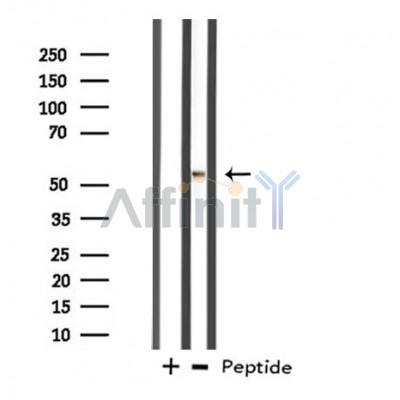 Western blot analysis of extracts from various samples, using DDX19B Antibody. Lane 1: Hela treated with the antigen-specific peptide. Lane 2: Hela; Lane 3: 293; 