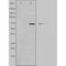 DF3819 staining HepG2 by IF/ICC. The sample were fixed with PFA and permeabilized in 0.1% Triton X-100,then blocked in 10% serum for 45 minutes at 25¡ãC. The primary antibody was diluted at 1/200 and incubated with the sample for 1 hour at 37¡ãC. An  Alexa Fluor 594 conjugated goat anti-rabbit IgG (H+L) Ab, diluted at 1/600, was used as the secondary antibod