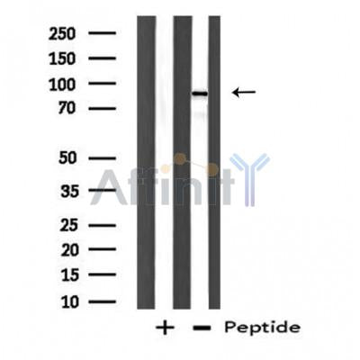 DF3820 staining CoLo by IF/ICC. The sample were fixed with PFA and permeabilized in 0.1% Triton X-100,then blocked in 10% serum for 45 minutes at 25¡ãC. The primary antibody was diluted at 1/200 and incubated with the sample for 1 hour at 37¡ãC. An  Alexa Fluor 594 conjugated goat anti-rabbit IgG (H+L) Ab, diluted at 1/600, was used as the secondary antibod