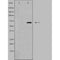 DF3821 staining  HeLa cells by IF/ICC. The sample were fixed with PFA and permeabilized in 0.1% Triton X-100,then blocked in 10% serum for 45 minutes at 25¡ãC. The primary antibody was diluted at 1/200 and incubated with the sample for 1 hour at 37¡ãC. An  Alexa Fluor 594 conjugated goat anti-rabbit IgG (H+L) antibody(Cat.# S0006), diluted at 1/600, was used as secondary antibod