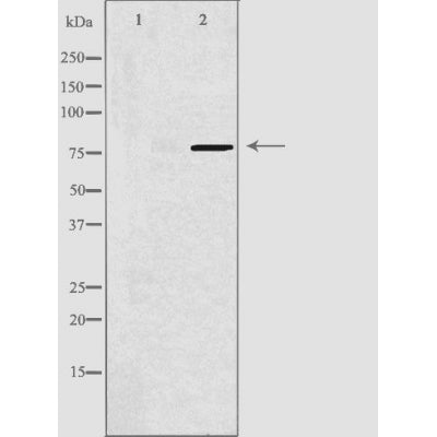 DF3823 staining HepG2 by IF/ICC. The sample were fixed with PFA and permeabilized in 0.1% Triton X-100,then blocked in 10% serum for 45 minutes at 25¡ãC. The primary antibody was diluted at 1/200 and incubated with the sample for 1 hour at 37¡ãC. An  Alexa Fluor 594 conjugated goat anti-rabbit IgG (H+L) Ab, diluted at 1/600, was used as the secondary antibod