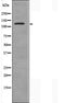 DF3824 staining HeLa cells by IF/ICC. The sample were fixed with PFA and permeabilized in 0.1% Triton X-100,then blocked in 10% serum for 45 minutes at 25¡ãC. The primary antibody was diluted at 1/200 and incubated with the sample for 1 hour at 37¡ãC. An  Alexa Fluor 594 conjugated goat anti-rabbit IgG (H+L) antibody(Cat.