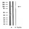 DF3826 at 1/100 staining Human Melanoma tissue by IHC-P. The sample was formaldehyde fixed and a heat mediated antigen retrieval step in citrate buffer was performed. The sample was then blocked and incubated with the antibody for 1.5 hours at 22¡ãC. An HRP conjugated goat anti-rabbit antibody was used as the secondary