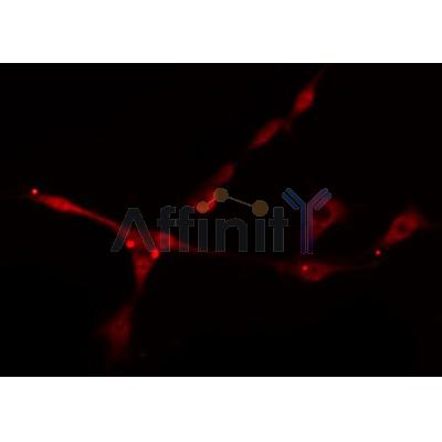 Western blot analysis of extracts from various samples, using BNIP2 Antibody.
 Lane 1: mouse brain treated with blocking peptide.
 Lane 2: mouse brain;
 Lane 3: rat barin;
 