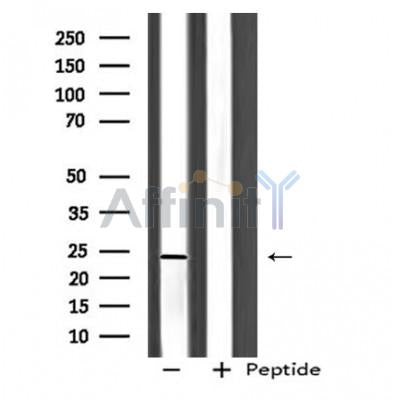 Western blot analysis of BOK  using PC-3 whole cell lysates