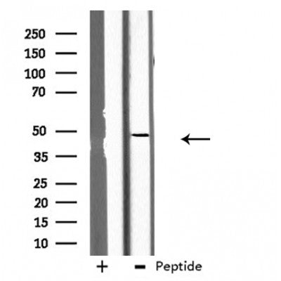 DF3832 at 1/100 staining Mouse liver tissue by IHC-P. The sample was formaldehyde fixed and a heat mediated antigen retrieval step in citrate buffer was performed. The sample was then blocked and incubated with the antibody for 1.5 hours at 22¡ãC. An HRP conjugated goat anti-rabbit antibody was used as the secondary