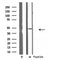 DF3832 at 1/100 staining Mouse liver tissue by IHC-P. The sample was formaldehyde fixed and a heat mediated antigen retrieval step in citrate buffer was performed. The sample was then blocked and incubated with the antibody for 1.5 hours at 22¡ãC. An HRP conjugated goat anti-rabbit antibody was used as the secondary