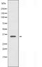 DF3833 staining HuvEc by IF/ICC. The sample were fixed with PFA and permeabilized in 0.1% Triton X-100,then blocked in 10% serum for 45 minutes at 25¡ãC. The primary antibody was diluted at 1/200 and incubated with the sample for 1 hour at 37¡ãC. An  Alexa Fluor 594 conjugated goat anti-rabbit IgG (H+L) Ab, diluted at 1/600, was used as the secondary antibod