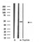 DF3840 at 1/100 staining Mouse testis tissue by IHC-P. The sample was formaldehyde fixed and a heat mediated antigen retrieval step in citrate buffer was performed. The sample was then blocked and incubated with the antibody for 1.5 hours at 22¡ãC. An HRP conjugated goat anti-rabbit antibody was used as the secondary
