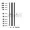 DF3847 staining Hela by IF/ICC. The sample were fixed with PFA and permeabilized in 0.1% Triton X-100,then blocked in 10% serum for 45 minutes at 25¡ãC. The primary antibody was diluted at 1/200 and incubated with the sample for 1 hour at 37¡ãC. An  Alexa Fluor 594 conjugated goat anti-rabbit IgG (H+L) Ab, diluted at 1/600, was used as the secondary antibod