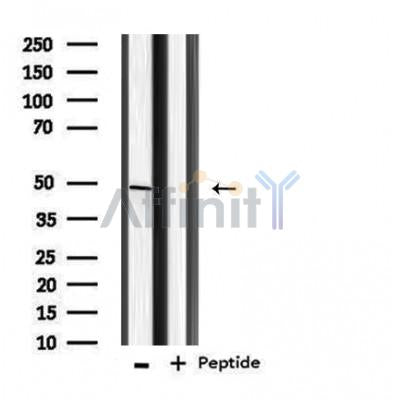 DF3847 staining Hela by IF/ICC. The sample were fixed with PFA and permeabilized in 0.1% Triton X-100,then blocked in 10% serum for 45 minutes at 25¡ãC. The primary antibody was diluted at 1/200 and incubated with the sample for 1 hour at 37¡ãC. An  Alexa Fluor 594 conjugated goat anti-rabbit IgG (H+L) Ab, diluted at 1/600, was used as the secondary antibod
