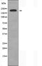 DF3859 staining HepG2 by IF/ICC. The sample were fixed with PFA and permeabilized in 0.1% Triton X-100,then blocked in 10% serum for 45 minutes at 25¡ãC. The primary antibody was diluted at 1/200 and incubated with the sample for 1 hour at 37¡ãC. An  Alexa Fluor 594 conjugated goat anti-rabbit IgG (H+L) Ab, diluted at 1/600, was used as the secondary antibod