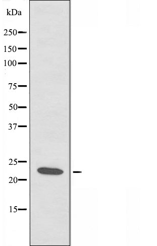 Western blot analysis of extracts from HeLa cells, using RCAN1 antibody.