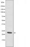 Western blot analysis of extracts from HeLa cells, using RCAN1 antibody.