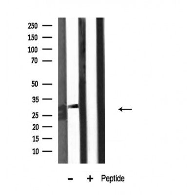 DF3862 staining Hela by IF/ICC. The sample were fixed with PFA and permeabilized in 0.1% Triton X-100,then blocked in 10% serum for 45 minutes at 25¡ãC. The primary antibody was diluted at 1/200 and incubated with the sample for 1 hour at 37¡ãC. An  Alexa Fluor 594 conjugated goat anti-rabbit IgG (H+L) Ab, diluted at 1/600, was used as the secondary antibod