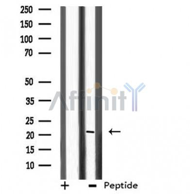DF3864 staining HeLa by IF/ICC. The sample were fixed with PFA and permeabilized in 0.1% Triton X-100,then blocked in 10% serum for 45 minutes at 25¡ãC. The primary antibody was diluted at 1/200 and incubated with the sample for 1 hour at 37¡ãC. An  Alexa Fluor 594 conjugated goat anti-rabbit IgG (H+L) Ab, diluted at 1/600, was used as the secondary antibod
