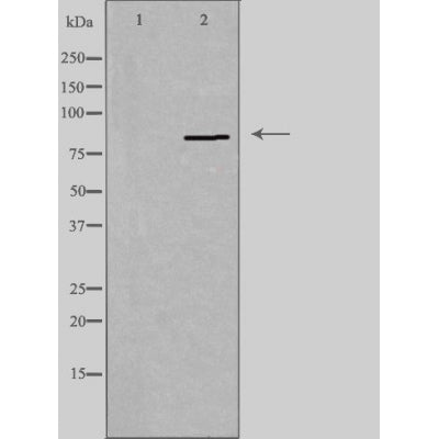 DF3865 staining  HuvEc cells by IF/ICC. The sample were fixed with PFA and permeabilized in 0.1% Triton X-100,then blocked in 10% serum for 45 minutes at 25¡ãC. The primary antibody was diluted at 1/200 and incubated with the sample for 1 hour at 37¡ãC. An  Alexa Fluor 594 conjugated goat anti-rabbit IgG (H+L) antibody(Cat.# S0006), diluted at 1/600, was used as secondary antibod