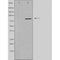 DF3865 staining  HuvEc cells by IF/ICC. The sample were fixed with PFA and permeabilized in 0.1% Triton X-100,then blocked in 10% serum for 45 minutes at 25¡ãC. The primary antibody was diluted at 1/200 and incubated with the sample for 1 hour at 37¡ãC. An  Alexa Fluor 594 conjugated goat anti-rabbit IgG (H+L) antibody(Cat.# S0006), diluted at 1/600, was used as secondary antibod