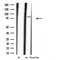 DF3866 staining LOVO cells by IF/ICC. The sample were fixed with PFA and permeabilized in 0.1% Triton X-100,then blocked in 10% serum for 45 minutes at 25¡ãC. The primary antibody was diluted at 1/200 and incubated with the sample for 1 hour at 37¡ãC. An  Alexa Fluor 594 conjugated goat anti-rabbit IgG (H+L) antibody(Cat.# S0006), diluted at 1/600, was used as secondary antibod