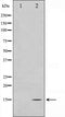 Western blot analysis on NIH-3T3 cell lysate using MLANA Antibody. The lane on the left is treated with the antigen-specific peptide.