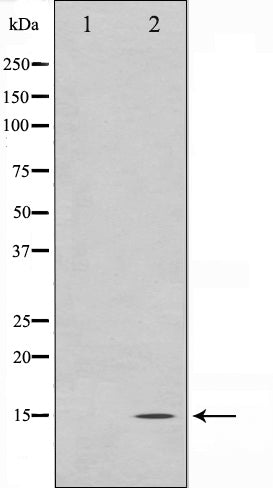 Western blot analysis on NIH-3T3 cell lysate using MLANA Antibody. The lane on the left is treated with the antigen-specific peptide.