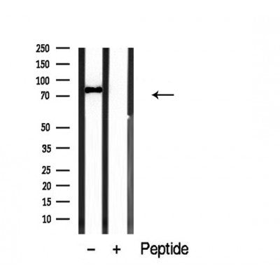 DF3872 staining A549 cells by IF/ICC. The sample were fixed with PFA and permeabilized in 0.1% Triton X-100,then blocked in 10% serum for 45 minutes at 25¡ãC. The primary antibody was diluted at 1/200 and incubated with the sample for 1 hour at 37¡ãC. An  Alexa Fluor 594 conjugated goat anti-rabbit IgG (H+L) antibody(Cat.# S0006), diluted at 1/600, was used as secondary antibod