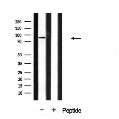 DF3875 at 1/100 staining Human lung tissue by IHC-P. The sample was formaldehyde fixed and a heat mediated antigen retrieval step in citrate buffer was performed. The sample was then blocked and incubated with the antibody for 1.5 hours at 22¡ãC. An HRP conjugated goat anti-rabbit antibody was used as the secondary