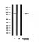 DF3875 at 1/100 staining Human lung tissue by IHC-P. The sample was formaldehyde fixed and a heat mediated antigen retrieval step in citrate buffer was performed. The sample was then blocked and incubated with the antibody for 1.5 hours at 22¡ãC. An HRP conjugated goat anti-rabbit antibody was used as the secondary