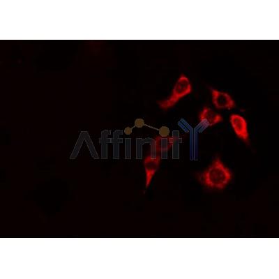 DF3877 staining HepG2 by IF/ICC. The sample were fixed with PFA and permeabilized in 0.1% Triton X-100,then blocked in 10% serum for 45 minutes at 25¡ãC. The primary antibody was diluted at 1/200 and incubated with the sample for 1 hour at 37¡ãC. An  Alexa Fluor 594 conjugated goat anti-rabbit IgG (H+L) Ab, diluted at 1/600, was used as the secondary antibod