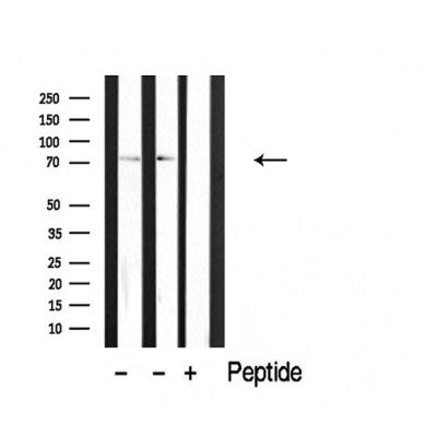 DF3879 staining HepG2 by IF/ICC. The sample were fixed with PFA and permeabilized in 0.1% Triton X-100,then blocked in 10% serum for 45 minutes at 25¡ãC. The primary antibody was diluted at 1/200 and incubated with the sample for 1 hour at 37¡ãC. An  Alexa Fluor 594 conjugated goat anti-rabbit IgG (H+L) Ab, diluted at 1/600, was used as the secondary antibod