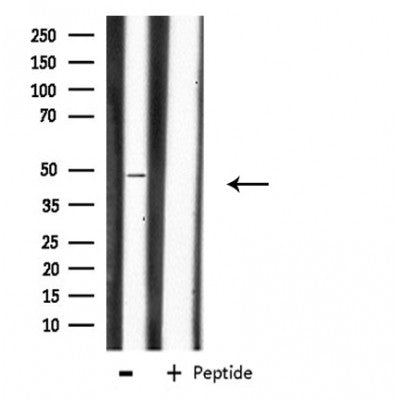 DF3880 staining Hela by IF/ICC. The sample were fixed with PFA and permeabilized in 0.1% Triton X-100,then blocked in 10% serum for 45 minutes at 25¡ãC. The primary antibody was diluted at 1/200 and incubated with the sample for 1 hour at 37¡ãC. An  Alexa Fluor 594 conjugated goat anti-rabbit IgG (H+L) Ab, diluted at 1/600, was used as the secondary antibod