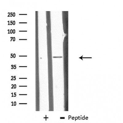DF3881 at 1/100 staining Mouse testis tissue by IHC-P. The sample was formaldehyde fixed and a heat mediated antigen retrieval step in citrate buffer was performed. The sample was then blocked and incubated with the antibody for 1.5 hours at 22¡ãC. An HRP conjugated goat anti-rabbit antibody was used as the secondary