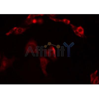 Western blot analysis of extracts from rat brain, using CHST13 Antibody. Lane 1 was treated with the blocking peptide.