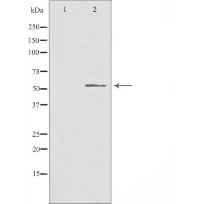DF3883 staining A549 by IF/ICC. The sample were fixed with PFA and permeabilized in 0.1% Triton X-100,then blocked in 10% serum for 45 minutes at 25¡ãC. The primary antibody was diluted at 1/200 and incubated with the sample for 1 hour at 37¡ãC. An  Alexa Fluor 594 conjugated goat anti-rabbit IgG (H+L) Ab, diluted at 1/600, was used as the secondary antibod