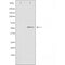 DF3883 staining A549 by IF/ICC. The sample were fixed with PFA and permeabilized in 0.1% Triton X-100,then blocked in 10% serum for 45 minutes at 25¡ãC. The primary antibody was diluted at 1/200 and incubated with the sample for 1 hour at 37¡ãC. An  Alexa Fluor 594 conjugated goat anti-rabbit IgG (H+L) Ab, diluted at 1/600, was used as the secondary antibod