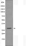 DF3885 at 1/100 staining Human prostate tissue by IHC-P. The sample was formaldehyde fixed and a heat mediated antigen retrieval step in citrate buffer was performed. The sample was then blocked and incubated with the antibody for 1.5 hours at 22¡ãC. An HRP conjugated goat anti-rabbit antibody was used as the secondary