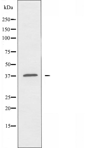DF3886 staining MCF7 by IF/ICC. The sample were fixed with PFA and permeabilized in 0.1% Triton X-100,then blocked in 10% serum for 45 minutes at 25¡ãC. The primary antibody was diluted at 1/200 and incubated with the sample for 1 hour at 37¡ãC. An  Alexa Fluor 594 conjugated goat anti-rabbit IgG (H+L) Ab, diluted at 1/600, was used as the secondary antibod