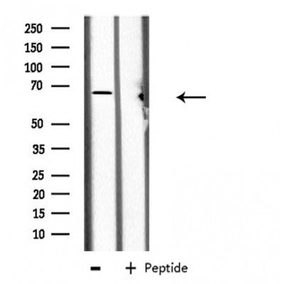 DF3895 at 1/100 staining Mouse liver tissue by IHC-P. The sample was formaldehyde fixed and a heat mediated antigen retrieval step in citrate buffer was performed. The sample was then blocked and incubated with the antibody for 1.5 hours at 22¡ãC. An HRP conjugated goat anti-rabbit antibody was used as the secondary