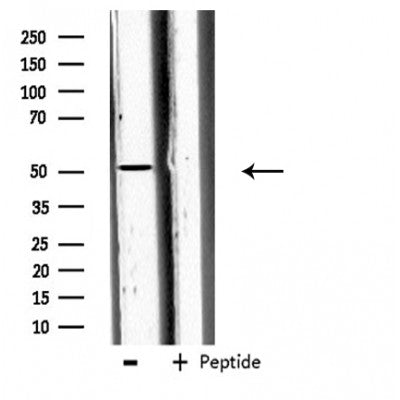 DF3896 staining 293 by IF/ICC. The sample were fixed with PFA and permeabilized in 0.1% Triton X-100,then blocked in 10% serum for 45 minutes at 25¡ãC. The primary antibody was diluted at 1/200 and incubated with the sample for 1 hour at 37¡ãC. An  Alexa Fluor 594 conjugated goat anti-rabbit IgG (H+L) Ab, diluted at 1/600, was used as the secondary antibod