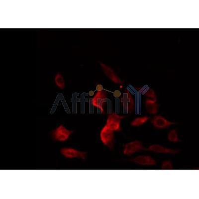 DF3898 staining Hela by IF/ICC. The sample were fixed with PFA and permeabilized in 0.1% Triton X-100,then blocked in 10% serum for 45 minutes at 25¡ãC. The primary antibody was diluted at 1/200 and incubated with the sample for 1 hour at 37¡ãC. An  Alexa Fluor 594 conjugated goat anti-rabbit IgG (H+L) Ab, diluted at 1/600, was used as the secondary antibod