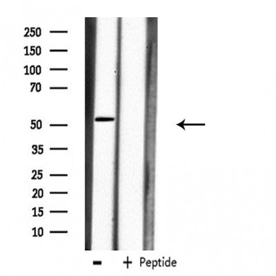 DF3899 staining A549 by IF/ICC. The sample were fixed with PFA and permeabilized in 0.1% Triton X-100,then blocked in 10% serum for 45 minutes at 25¡ãC. The primary antibody was diluted at 1/200 and incubated with the sample for 1 hour at 37¡ãC. An  Alexa Fluor 594 conjugated goat anti-rabbit IgG (H+L) Ab, diluted at 1/600, was used as the secondary antibod