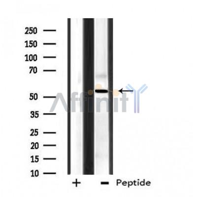 DF3901 staining HeLa by IF/ICC. The sample were fixed with PFA and permeabilized in 0.1% Triton X-100,then blocked in 10% serum for 45 minutes at 25¡ãC. The primary antibody was diluted at 1/200 and incubated with the sample for 1 hour at 37¡ãC. An  Alexa Fluor 594 conjugated goat anti-rabbit IgG (H+L) Ab, diluted at 1/600, was used as the secondary antibod