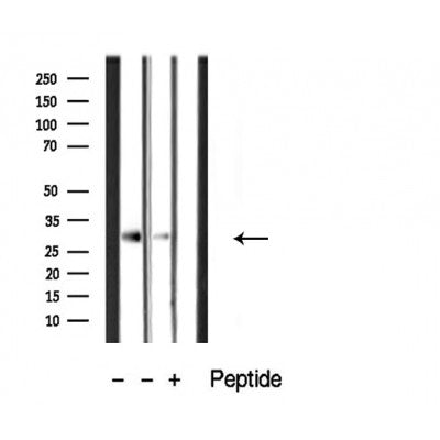 DF3902 at 1/100 staining Mouse spleen tissue by IHC-P. The sample was formaldehyde fixed and a heat mediated antigen retrieval step in citrate buffer was performed. The sample was then blocked and incubated with the antibody for 1.5 hours at 22¡ãC. An HRP conjugated goat anti-rabbit antibody was used as the secondary