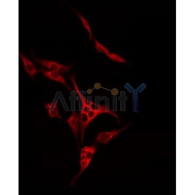 DF3906 staining Hela by IF/ICC. The sample were fixed with PFA and permeabilized in 0.1% Triton X-100,then blocked in 10% serum for 45 minutes at 25¡ãC. The primary antibody was diluted at 1/200 and incubated with the sample for 1 hour at 37¡ãC. An  Alexa Fluor 594 conjugated goat anti-rabbit IgG (H+L) Ab, diluted at 1/600, was used as the secondary antibod