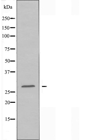 DF3908 staining Hela cells by IF/ICC. The sample were fixed with PFA and permeabilized in 0.1% Triton X-100,then blocked in 10% serum for 45 minutes at 25¡ãC. The primary antibody was diluted at 1/200 and incubated with the sample for 1 hour at 37¡ãC. An  Alexa Fluor 594 conjugated goat anti-rabbit IgG (H+L) antibody(Cat.# S0006), diluted at 1/600, was used as secondary antibod