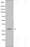 DF3908 staining Hela cells by IF/ICC. The sample were fixed with PFA and permeabilized in 0.1% Triton X-100,then blocked in 10% serum for 45 minutes at 25¡ãC. The primary antibody was diluted at 1/200 and incubated with the sample for 1 hour at 37¡ãC. An  Alexa Fluor 594 conjugated goat anti-rabbit IgG (H+L) antibody(Cat.# S0006), diluted at 1/600, was used as secondary antibod