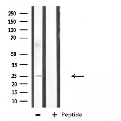 Western blot analysis of extracts from various samples, using BORG2 Antibody.
 Lane 1: 293 treated with blocking peptide.
 Lane 2: 293;
 Lane 3: hela;
 