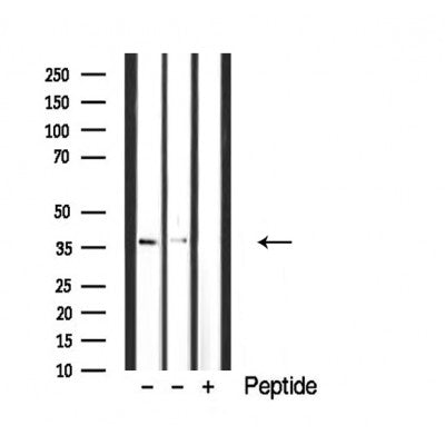 DF3910 staining Hela cells by IF/ICC. The sample were fixed with PFA and permeabilized in 0.1% Triton X-100,then blocked in 10% serum for 45 minutes at 25¡ãC. The primary antibody was diluted at 1/200 and incubated with the sample for 1 hour at 37¡ãC. An  Alexa Fluor 594 conjugated goat anti-rabbit IgG (H+L) antibody(Cat.# S0006), diluted at 1/600, was used as secondary antibod